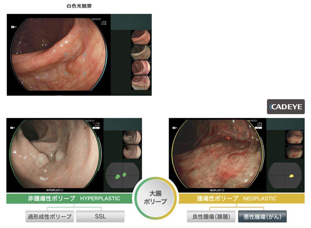 最新鋭の内視鏡システムイメージ