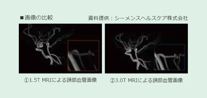特長イメージ:MRI画像