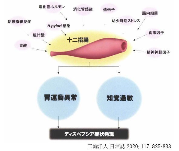 機能性ディスペプシアの原因イメージ