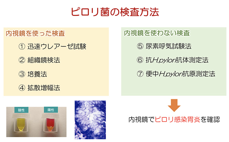 ピロリ菌の検査方法